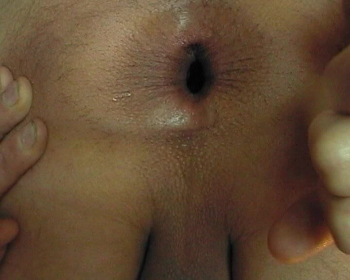 Asshole therapy: Aws49 - Sání vyvětšte zadek