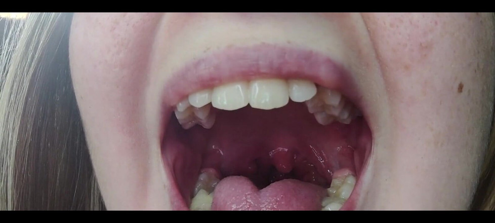 RavenHearth666VIP: Keelfetisj