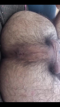 My Asshole in Close-up