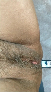 I Am on a Sex Swing Enjoying Being Fucked. Not Bad for Being 72.