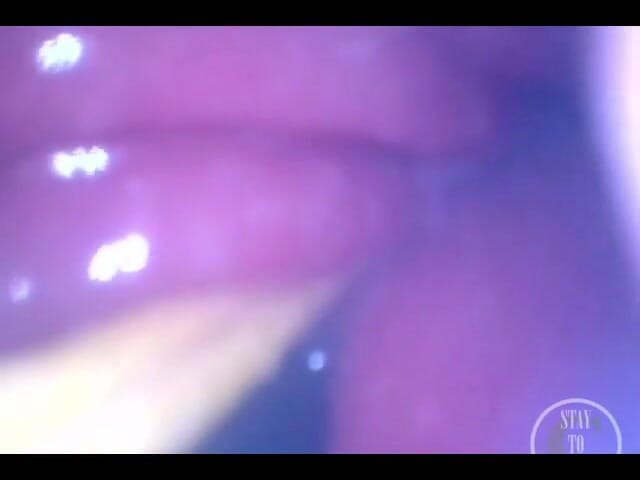 Lina Free: PUNTO di vista: Deporre le uova mentre sei nel mio...