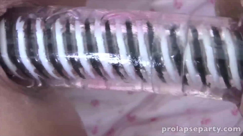Prolapse party: Duplo prolapso dildo