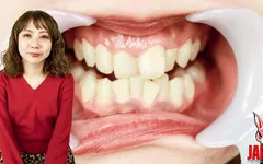 Dentro de la boca de Rumi: ¡explora sus secretos para el cuidado dental!