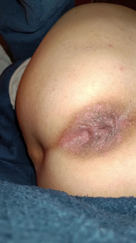 My Anus