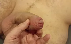 Memeriksa penis besar