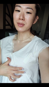 Day 3 Post Op