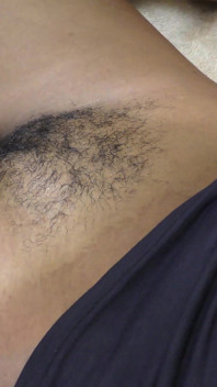 Memek berbulu hitam siap untuk kontol putih besar