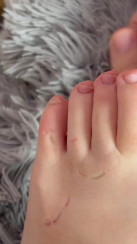 Morsando i piedi duri