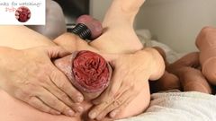 Popoopoop: 포푸푸프. 내 프롤랩스 파티 - 내 로즈버드 펌프 - 프롤랩스 플레이 - 탈출 펌프 - 애널 로즈