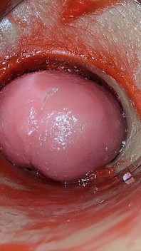 Une Caméra À L’intérieur D’une Chatte Profonde Capture L’éjaculation Par Surdose De Sperme Asmr