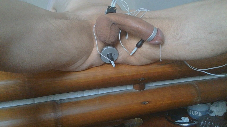 Prostatecumer: De aanzien is zo goed
