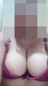 A Chubby Body and Fatal Curves