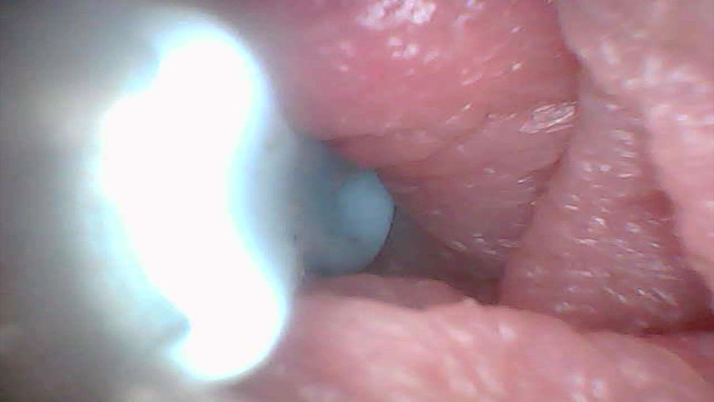 Twittiy: Diamo una sbirciatina nella mia figa succosa insieme (endoscope camera)