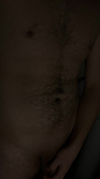 My Hairy Body