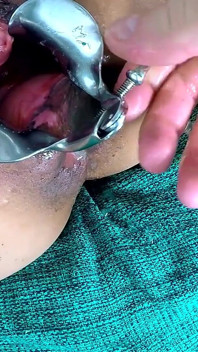 Exl-032: Speculum imens în Curul N Pizdă. Prolaps uriaș și col uterin uriaș. Scenă completă extremă latino exl-032