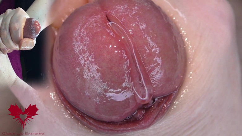 Close Up Extreme: Super Close-up of the Glans. Urethral Games with the Dilator.
