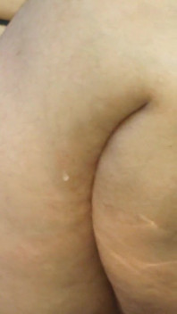 Buceta torta