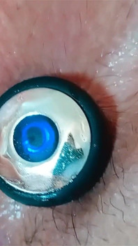 Anal Training with a Dilator, Followed by Intense Vaginal and Anal Sex with Internal Anal Ejaculation.