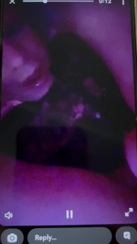 Face on