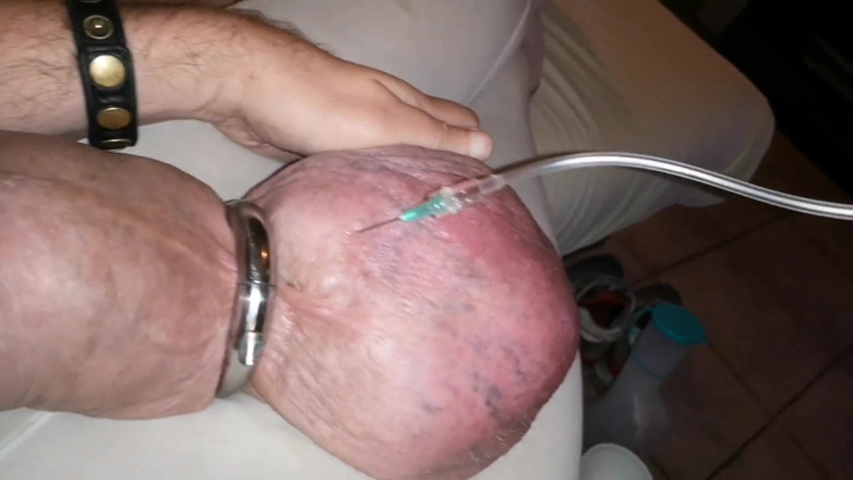 Monster_Meat_: Riempio di glucosio 1litro