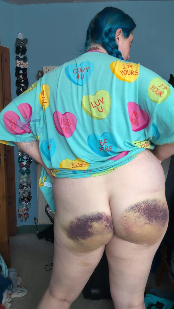 Alice_Mayflower_Scottish: Very Bruised Ass Aftercare - Solo Girl