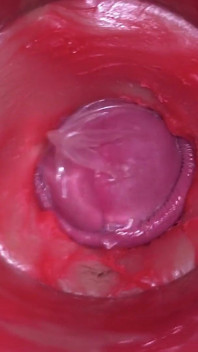 Camera Inside Pussy - Powerfull Cum in Pussy! Best Internal Asmr