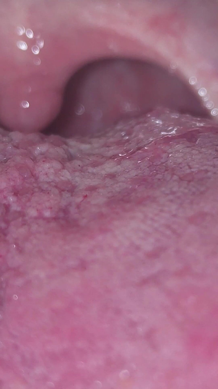 AngYourDirtyCanadian: Uvula Joc: gura adâncă de aproape?sus