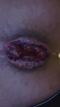 My Hole
