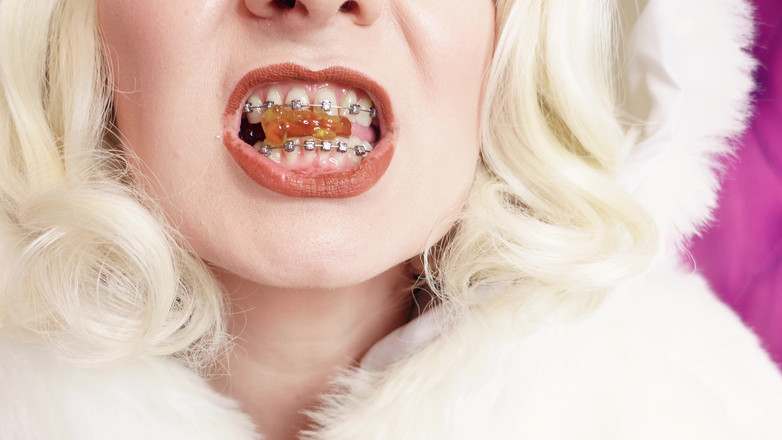 Arya Grander: ASMR: jedzenie galaretki misiów z aparatami ortodontycznymi w białym futrze (Arya...