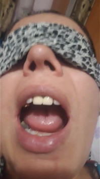 Muscatura De Deget