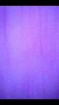 Magnifique à l’intérieur de ma vessie complète avec l’endoscope !