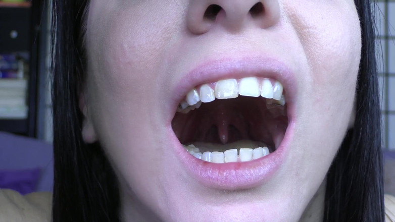 Quinn brooks: My Uvula