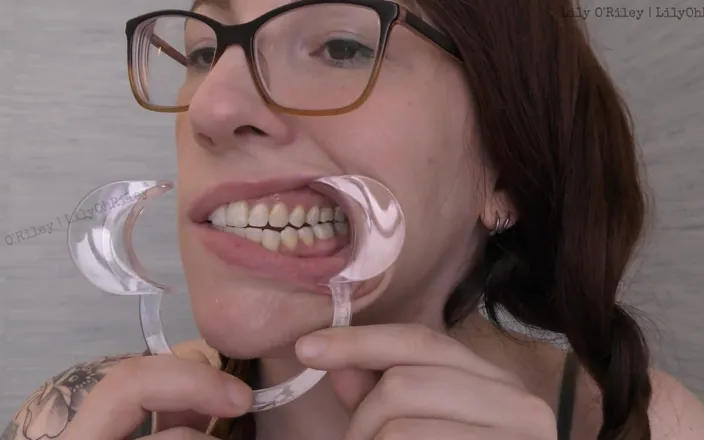 Lily O'Riley: Sloppy Drooling Mouth Fetish W/cheek Spreader
