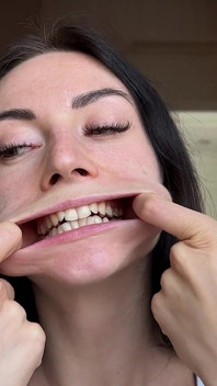 Étirement de la bouche et gros yeux