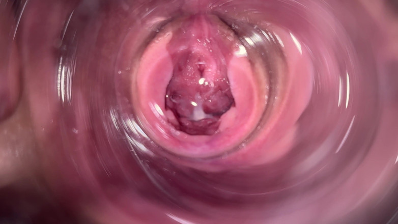Mia Foster: Camera Deep Inside Mia's Creamy Pussy, Teen Cervix Close up