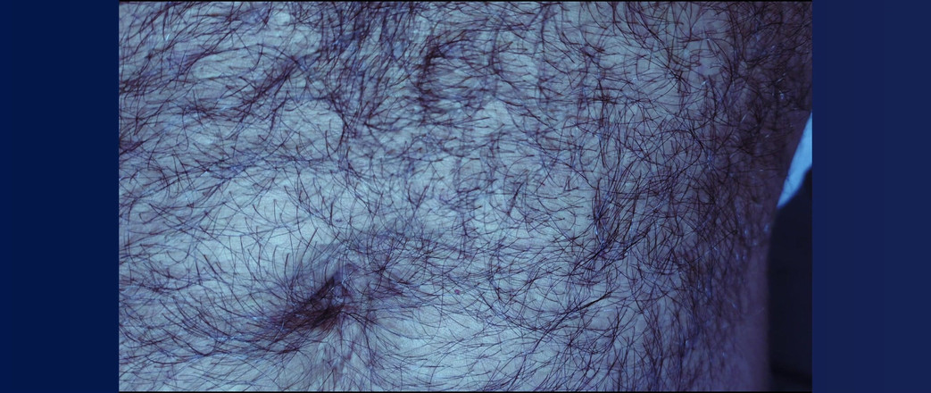 Stink HairyMale: Bauch, Achseln und Penis