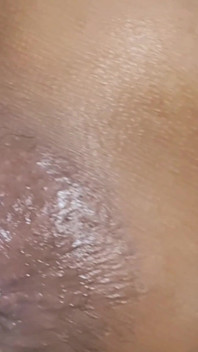 Trying to Get the Sperm Out, It Was so Deep That It Didn't Come Out
