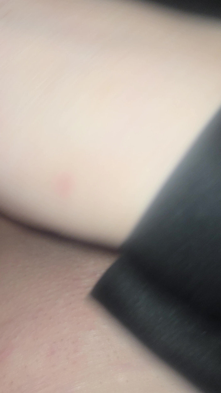 SwollenCougar: Usando mi puño de goma.