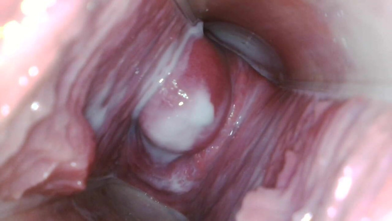 JANA studios: Endoscope in my pussy