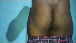 Indian Dick