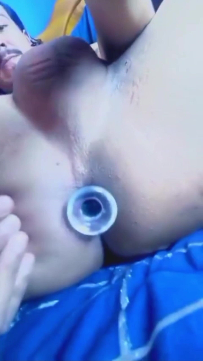 Arterotiko: Anal Plug