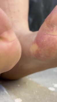 POV BBW Mistress Catastrov Wielbienie Stóp - Napraw moje zmęczone, zniszczone stopy