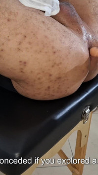 Šel k urologovi, protože už necítil potěšení a ona do něj strčila připínák, dokud nepřišel.