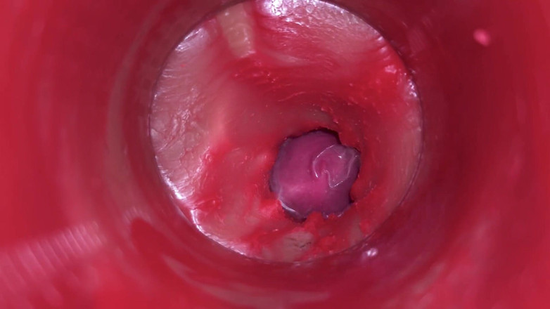 Ladybottox: Kamera dalam memek: memeknya dicrot sperma banyak bangek! Asmr Internal...