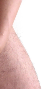 Depilación de pene con varios pelos