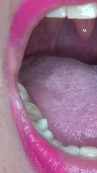 Showing My Super Power to You!!!! Super Uvula