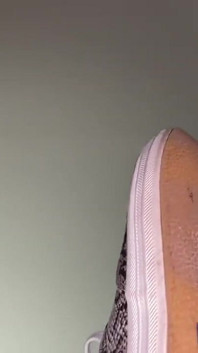 Pink foxx si toglie le scarpe dopo una lunga giornata