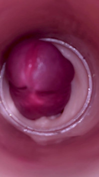 Vrouwelijke inseminatie - interne camera legt diepe mannelijke ejaculatie vast
