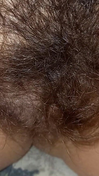 Shorts Hairy