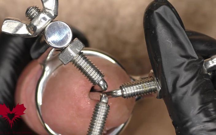 Close Up Extreme: Close-up van de toepassing van een 3-weg urethrale stretcher. de dilatator...